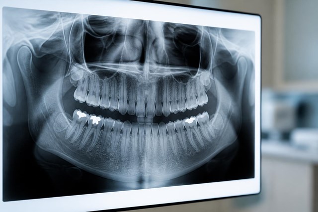 Estudio dental prequirúrgico personalizado en Alcorcón - Imagen 1