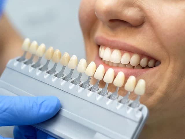 Servicio de estética dental en Alcorcón