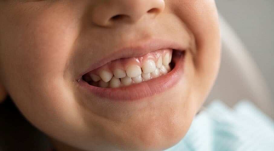 Enseñando hábitos de higiene dental a niños en Alcorcón