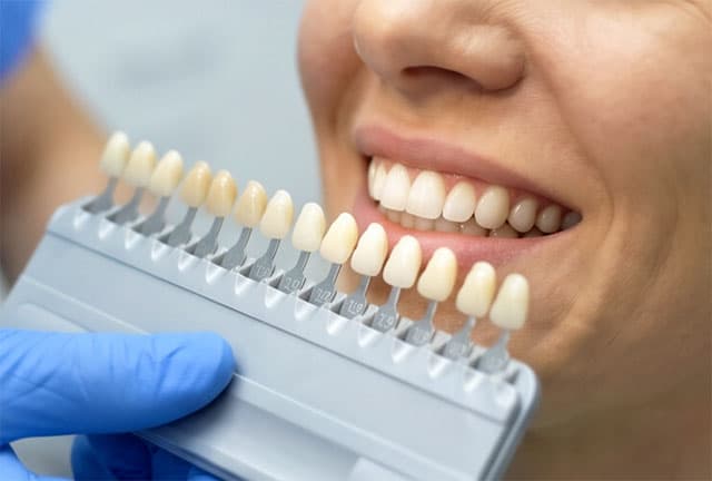 Tratamientos de estética dental en la clínica Dr. Godino de Alcorcón