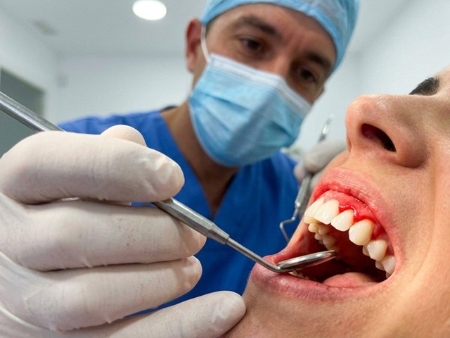 Prevención y tratamiento de la gingivitis en Alcorcón